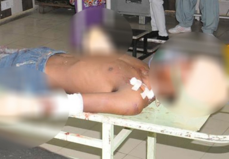 Pai corta as mãos de jovem que teria estuprado sua filha de 7 meses