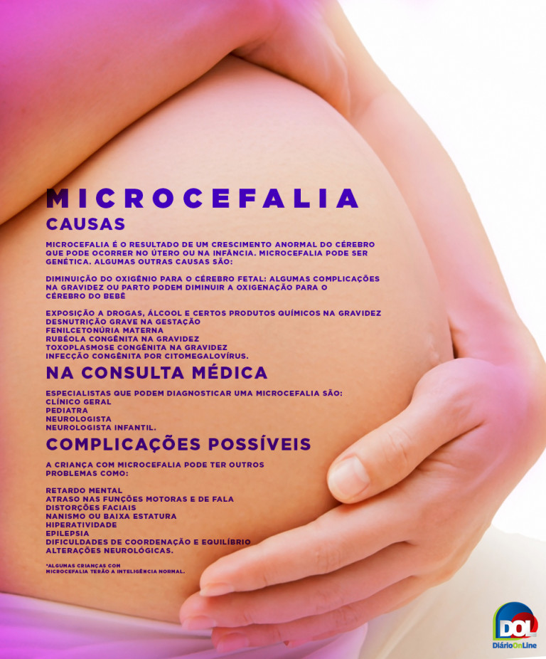 Cinco casos de microcefalia são confirmados no Tocantins