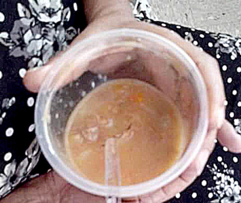 Faltam alimentos em seis hospitais públicos do Tocantins